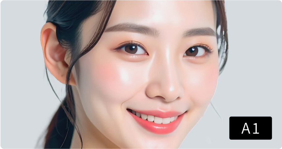 歯のシミュレーション画像